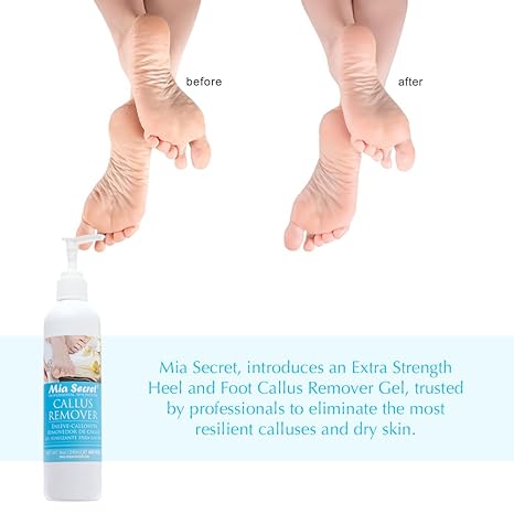 Mia Secret Callus Remover (8 OZ)